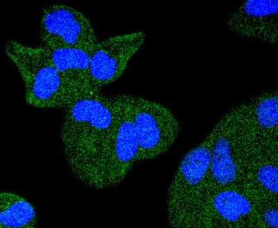 Immunocytochemistry/Immunofluorescence: TACC3 Antibody (SY10-06) [NBP2-67383] - Staining TACC3 in Hela cells (green). The nuclear counter stain is DAPI (blue). Cells were fixed in paraformaldehyde, permeabilised with 0.25% Triton X100/PBS.