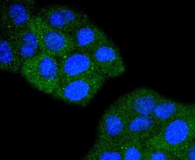 Immunocytochemistry/Immunofluorescence: TACC3 Antibody (SY10-06) [NBP2-67383] - Staining TACC3 in HepG2 cells (green). The nuclear counter stain is DAPI (blue). Cells were fixed in paraformaldehyde, permeabilised with 0.25% Triton X100/PBS.