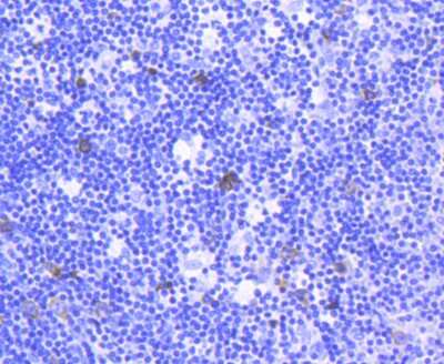 Immunohistochemistry-Paraffin: TACC3 Antibody (SY10-06) [NBP2-67383] - Analysis of paraffin-embedded human spleen tissue using anti-TACC3 antibody. Counter stained with hematoxylin.