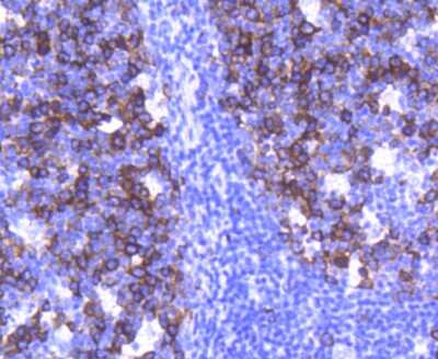 Immunohistochemistry-Paraffin: TACC3 Antibody (SY10-06) [NBP2-67383] - Analysis of paraffin-embedded human tonsil tissue using anti-TACC3 antibody. Counter stained with hematoxylin.