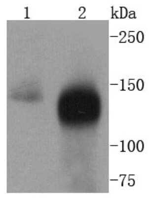 Western Blot: TACC3 Antibody (SY10-06) [NBP2-67383] - Analysis of TACC3 on different lysates using anti-TACC3 antibody at 1/1,000 dilution. Positive control: Lane 1: HT29 Lane 2: Hela