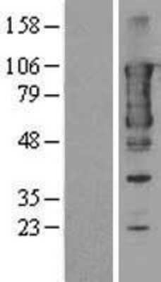 Western Blot TACC3 Overexpression Lysate