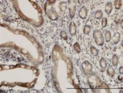Immunohistochemistry-Paraffin: TACE/ADAM17 Antibody (1F6) [H00006868-M01] - Analysis of monoclonal antibody to ADAM17 on formalin-fixed paraffin-embedded human small Intestine. Antibody concentration 3 ug/ml.