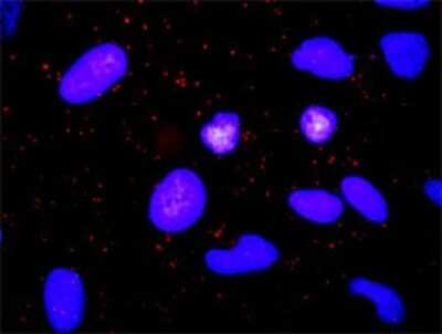 Proximity Ligation Assay: TACE/ADAM17 Antibody (1F6) [H00006868-M01] - Analysis of protein-protein interactions between TGFA and ADAM17. HeLa cells were stained with anti-TGFA rabbit purified polyclonal 1:1200 and anti-ADAM17 mouse monoclonal antibody 1:50. Each red dot represents the detection of protein-protein interaction complex, and nuclei were counterstained with DAPI (blue).