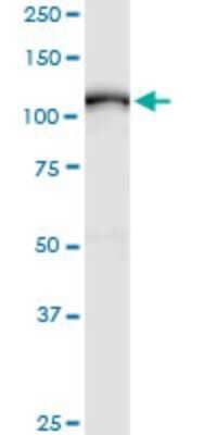 Western Blot: TACE/ADAM17 Antibody (1F6) [H00006868-M01] - ADAM17 monoclonal antibody (M01), clone 1F6. Analysis of ADAM17 expression in human spleen.