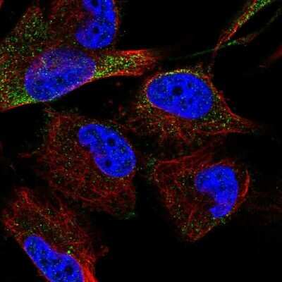 Immunocytochemistry/Immunofluorescence: TACE/ADAM17 Antibody [NBP2-58422] - Staining of human cell line U-251 MG shows localization to cytosol.