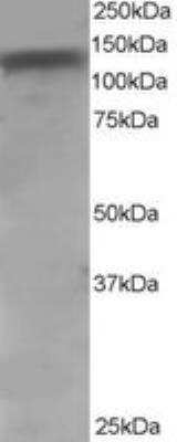 Western Blot: TACE/ADAM17 Antibody [NB100-1012] - Staining of Human HeLa lysate (RIPA buffer, 35 ug total protein per lane). Antibody at 0.2 ug/mL. Detected by chemiluminescence. 