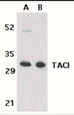 Western Blot: TACI/TNFRSF13B/CVID Antibody [NBP1-76779] - Western blot analysis of TACI in K562 (A) and U937 (B) cell lysates with TACI antibody at 5 ug/mL.