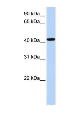 Western Blot: TADA1L Antibody [NBP1-56629] - Hela cell lysate, concentration 0.2-1 ug/ml.