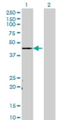 Western Blot: TADA3L Antibody (3H3) [H00010474-M02] - Analysis of TADA3L expression in transfected 293T cell line by TADA3L monoclonal antibody (M02), clone 3H3.Lane 1: TADA3L transfected lysate(41.4 KDa).Lane 2: Non-transfected lysate.