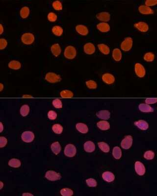 Immunocytochemistry/Immunofluorescence: TADA3L Antibody [NBP2-94077] - Analysis of C6 cells using TADA3L at dilution of 1:100. Blue: DAPI for nuclear staining.