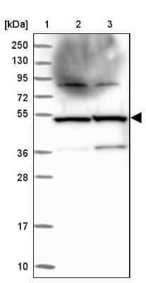 Western Blot: TADA3L Antibody [NBP1-90243] - Lane 1: Marker  [kDa] 250, 130, 95, 72, 55, 36, 28, 17, 10.  Lane 2: Human cell line RT-4.  Lane 3: Human cell line U-251MG sp