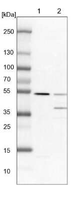 Western Blot: TADA3L Antibody [NBP1-90243] - Lane 1: NIH-3T3 cell lysate (Mouse embryonic fibroblast cells). Lane 2: NBT-II cell lysate (Rat Wistar bladder tumor cells).