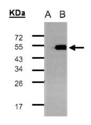 Western Blot: TADA3L Antibody [NBP2-20554] - Expression in transfected 293T cell line by TADA3L polyclonal antibody. A: Non-transfected lysate. B: TADA3L transfected lysate. 12% SDS PAGE gel, diluted at 1:500.