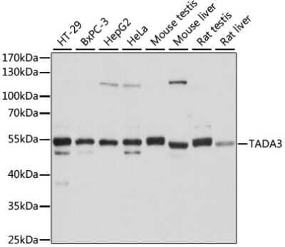 Western Blot: TADA3L Antibody [NBP2-94077] - Analysis of extracts of various cell lines, using TADA3L at 1:1000 dilution. Secondary antibody: HRP Goat Anti-Rabbit IgG (H+L) at 1:10000 dilution. Lysates/proteins: 25ug per lane. Blocking buffer: 3% nonfat dry milk in TBST. Detection: ECL Basic Kit . Exposure time: 10s.