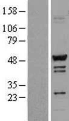 Western Blot: TADA3L Overexpression Lysate (Adult Normal) [NBL1-16678] Left-Empty vector transfected control cell lysate (HEK293 cell lysate); Right -Over-expression Lysate for TADA3L.