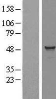 Western Blot: TADA3L Overexpression Lysate (Adult Normal) [NBL1-16679] Left-Empty vector transfected control cell lysate (HEK293 cell lysate); Right -Over-expression Lysate for TADA3L.