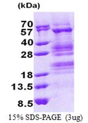 SDS-Page: TADA3L Protein [NBP2-22879]