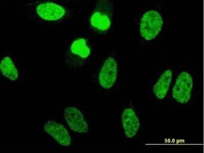 Immunocytochemistry/Immunofluorescence: TAF11 Antibody (3E7) [H00006882-M07] - Analysis of monoclonal antibody to TAF11 on HeLa cell. Antibody concentration 10 ug/ml