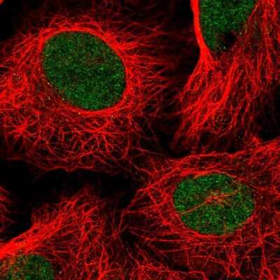Immunocytochemistry/Immunofluorescence: TAF11 Antibody [NBP2-55367] - Staining of human cell line U-2 OS shows localization to nucleoplasm.