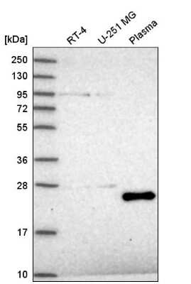 Western Blot: TAF11 Antibody [NBP2-55367] - Western blot analysis in human cell line RT-4, human cell line U-251 MG and human plasma.