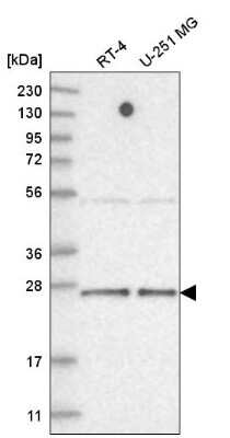 Western Blot: TAF11 Antibody [NBP2-58561] - Western blot analysis in human cell line RT-4 and human cell line U-251 MG.