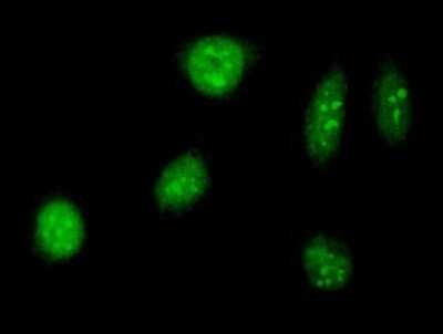Immunocytochemistry/Immunofluorescence: TAF12 Antibody [H00006883-B01P] - Analysis of purified antibody to TAF12 on HeLa cell. (antibody concentration 10 ug/ml)