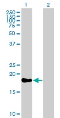 Western Blot: TAF12 Antibody [H00006883-B01P] - Analysis of TAF12 expression in transfected 293T cell line by TAF12 polyclonal antibody.  Lane1:TAF12 transfected lysate(17.82 KDa). Lane 2:Non-transfected lysate.