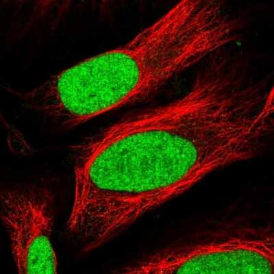 Immunocytochemistry/ Immunofluorescence TAF13 Antibody