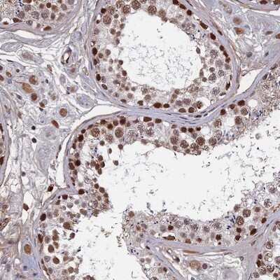 Immunohistochemistry-Paraffin TAF13 Antibody