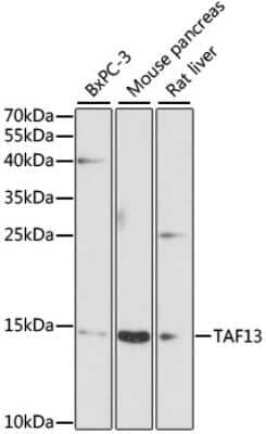 Western Blot: TAF13 Antibody [NBP2-93310] - Analysis of extracts of various cell lines, using TAF13 . Exposure time: 90s.