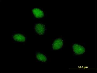 Immunocytochemistry/Immunofluorescence: TAF15 Antibody [H00008148-B01P] - Analysis of purified antibody to TAF15 on HeLa cell. (antibody concentration 10 ug/ml)