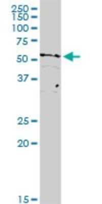 Western Blot: TAF15 Antibody [H00008148-D01P] - Analysis of TAF15 expression in human pancreas.