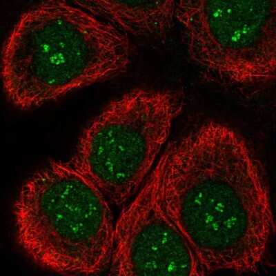 Immunocytochemistry/Immunofluorescence: TAF1C Antibody [NBP2-58841] - Staining of human cell line HaCaT shows localization to nucleus & nucleoli fibrillar center.