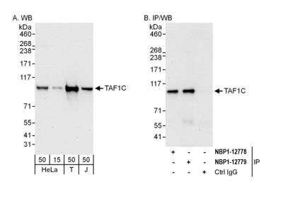 TAF1C Antibody [NBP2-12779] - Detection of human TAF1C by western blot and immunoprecipitation. Samples: Whole cell lysate from HeLa (15 and 50 ug for WB; 1 mg for IP, 20% of IP loaded), HEK293T (T; 50 ug) and Jurkat (J; 50 ug) cells. Antibodies: Affinity purified rabbit anti-TAF1C antibody NBP2-12779 used for WB at 0.1 ug/ml (A) and 1 ug/ml (B) and used for IP at 6 ug/mg lysate. TAF1C was also immunoprecipitated by rabbit anti-TAF1C antibody NBP2-12778, which recognizes an upstream epitope. Detection: Chemiluminescence with exposure times of 30 seconds (A and B).