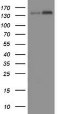 Western Blot: TAF2 Antibody (OTI2A5) - Azide and BSA Free [NBP2-74442] - HEK293T cells were transfected with the pCMV6-ENTRY control (Left lane) or pCMV6-ENTRY TAF2 (Right lane) cDNA for 48 hrs and lysed. Equivalent amounts of cell lysates (5 ug per lane) were separated by SDS-PAGE and immunoblotted with anti-TAF2.