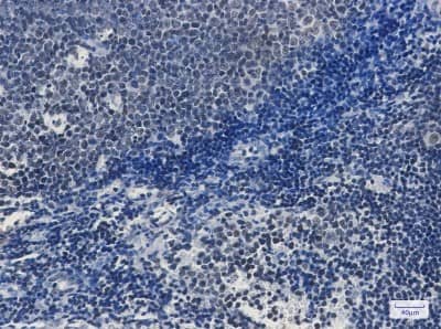 Immunohistochemistry-Paraffin TAF3 Antibody (S01-6A4)