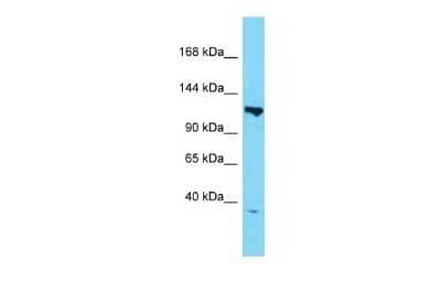 Western Blot: TAF3 Antibody [NBP2-85869] - Host: Rabbit. Target Name: Taf3. Sample Type: Mouse Heart lysates. Antibody Dilution: 1.0ug/ml