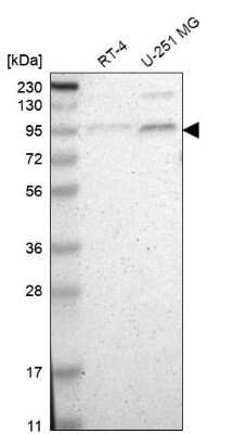 Western Blot: TAF5 Antibody [NBP1-86970] - Analysis in human cell line RT-4 and human cell line U-251 MG.