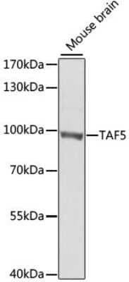 Western Blot: TAF5 Antibody [NBP2-93025] - Analysis of extracts of mouse brain, using TAF5 at 1:1000 dilution.Secondary antibody: HRP Goat Anti-Rabbit IgG (H+L) at 1:10000 dilution.Lysates/proteins: 25ug per lane.Blocking buffer: 3% nonfat dry milk in TBST.Detection: ECL Basic Kit .Exposure time: