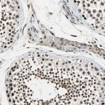 Immunohistochemistry-Paraffin: TAF6 Antibody [NBP1-82774] - Staining of human testis shows strong nuclear positivity in cells in seminiferous ducts.