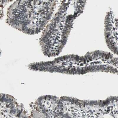 Immunohistochemistry-Paraffin: TAF6 Antibody [NBP1-82774] - Staining of human fallopian tube shows moderate nuclear positivity in a subset of glandular cells.