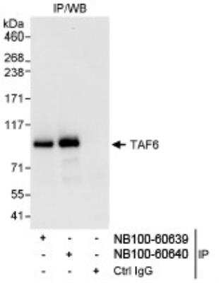 Immunoprecipitation: TAF6 Antibody [NB100-60639] - Detection of Human TAF6 by Western Blot of Immunoprecipitates.  Samples: Whole cell lysate (1 mg for IP, 20% of IP loaded) from HeLa cells. Antibodies: Affinity purified rabbit anti-TAF6 antibody NB100-60639 used for IP at 3 mcg/mg lysate. TAF6 was also immunoprecipitated by rabbit anti-TAF6 antibody NB100-60640, which recognizes a downstream epitope. Detection: Chemiluminescence with an exposure time of 10 seconds.