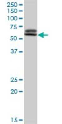 Western Blot: TAF6 Antibody [H00006878-D01P] - Analysis of TAF6 expression in Jurkat.