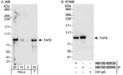 Western Blot: TAF6 Antibody [NB100-60640] - Detection of Human TAF6 on HeLa whole cell lysate. TAF6 was also immunoprecipitated by rabbit anti-TAF6 antibody NB100-60639.