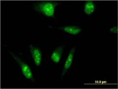 Immunocytochemistry/Immunofluorescence: TAF7L Antibody (3E10) [H00054457-M04] - Analysis of monoclonal antibody to TAF7L on HeLa cell. Antibody concentration 10 ug/ml