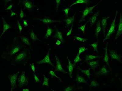 Immunocytochemistry/Immunofluorescence: TAF7L Antibody [NBP3-06642] - Immunofluorescence staining of TAF7L in Hela cells. Cells were fixed with 4% PFA, permeabilzed with 0.1% Triton X-100 in PBS, blocked with 10% serum, and incubated with NBP3-06642 (dilution ratio 1:200) at 4? overnight. Then cells were stained with the Alexa Fluor®488-conjugated Goat Anti-rabbit IgG secondary antibody (green). Positive staining was localized to Nucleus and Cytoplasm.