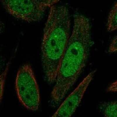 Immunocytochemistry/Immunofluorescence: TAF7L Antibody [NBP3-17772] - Staining of human cell line SiHa shows localization to nucleoplasm & cytosol.