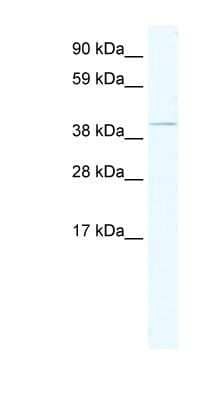 Western Blot: TAF7L Antibody [NBP1-80292] - SP2/0 cell lysate, concentration 1.25ug/ml.