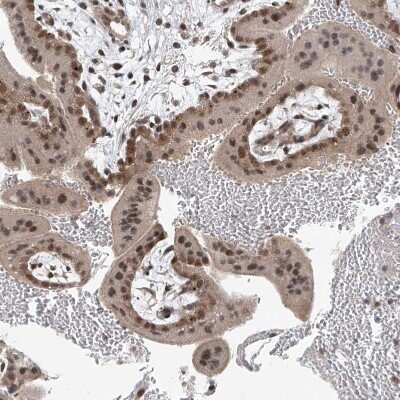 Immunohistochemistry-Paraffin: TAF8 Antibody [NBP2-38188] - Staining of human placenta shows moderate nuclear positivity in trophoblastic cells.